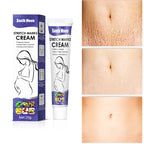 South Moon 20gNourishing Skin For Stretch Mark And Acne Scar Removal For Body