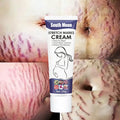 South Moon 20gNourishing Skin For Stretch Mark And Acne Scar Removal For Body