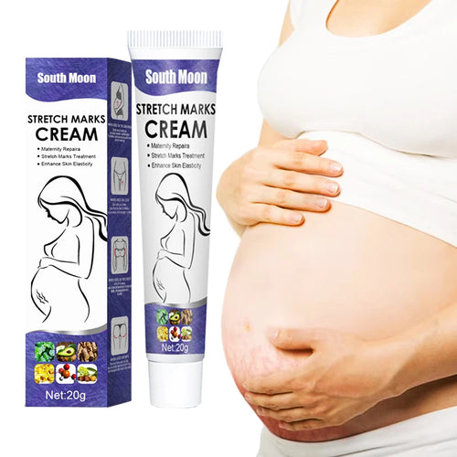 South Moon 20gNourishing Skin For Stretch Mark And Acne Scar Removal For Body
