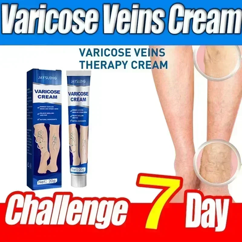 Varicose Vein Treatment for Legs | Spider Vein and Varicose Vein Cream | Collagen Protein