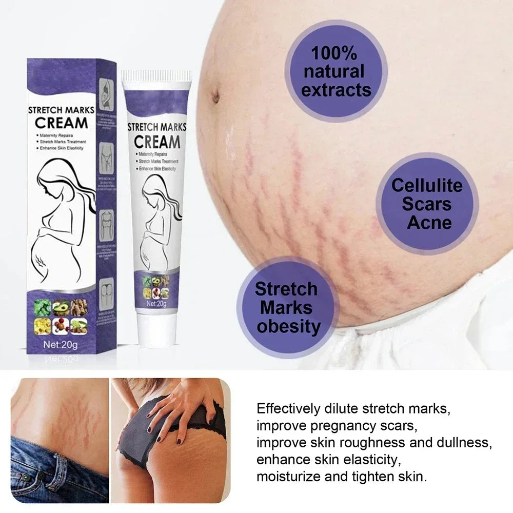 1ST Scar Repair Cream Anti