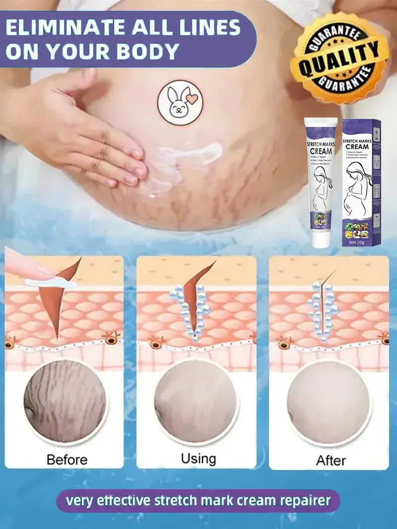1ST Scar Repair Cream Anti