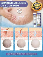 1ST Scar Repair Cream Anti