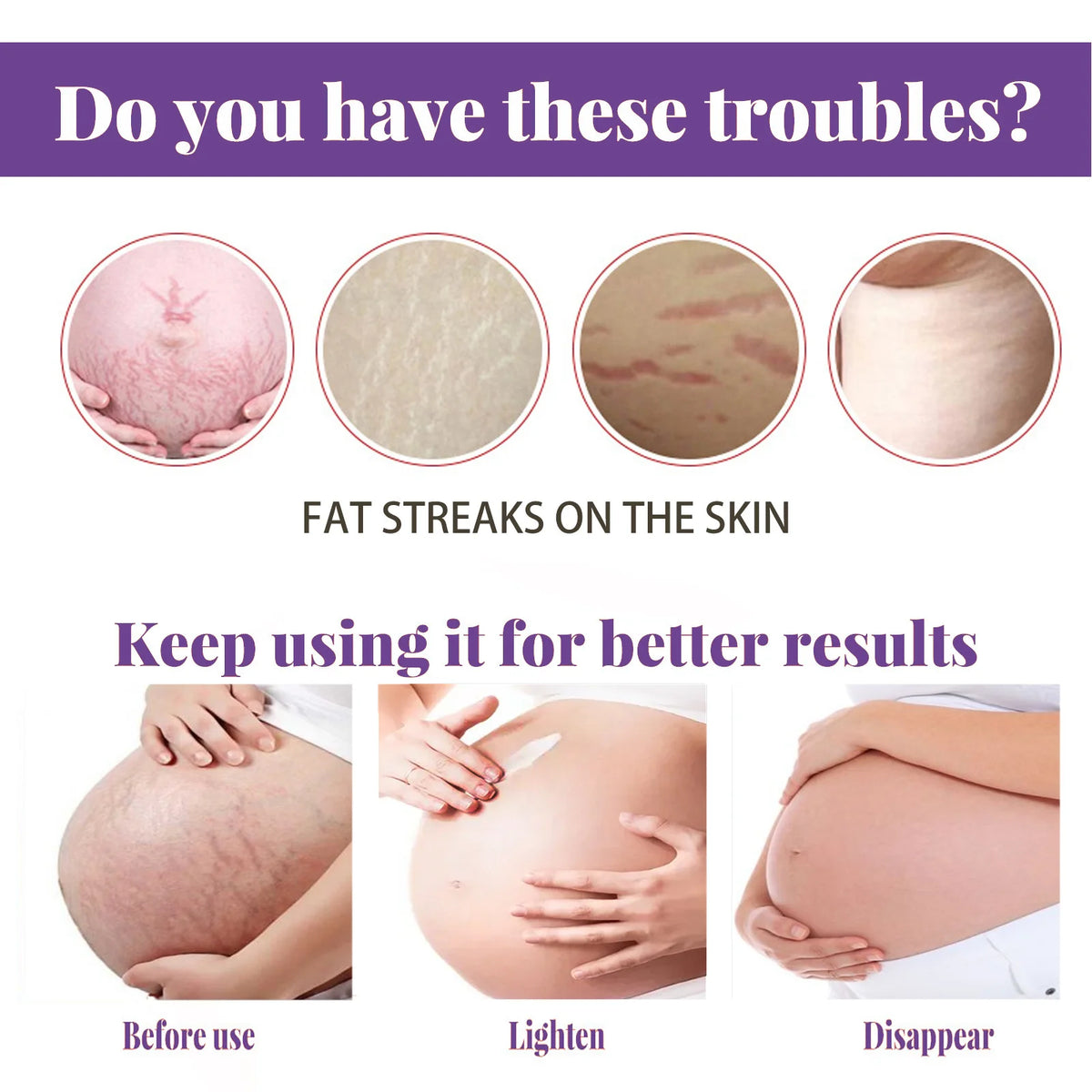 1ST Scar Repair Cream Anti