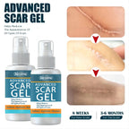 Jaysuing Fade Scar Cream Gel Skin Scar Repair