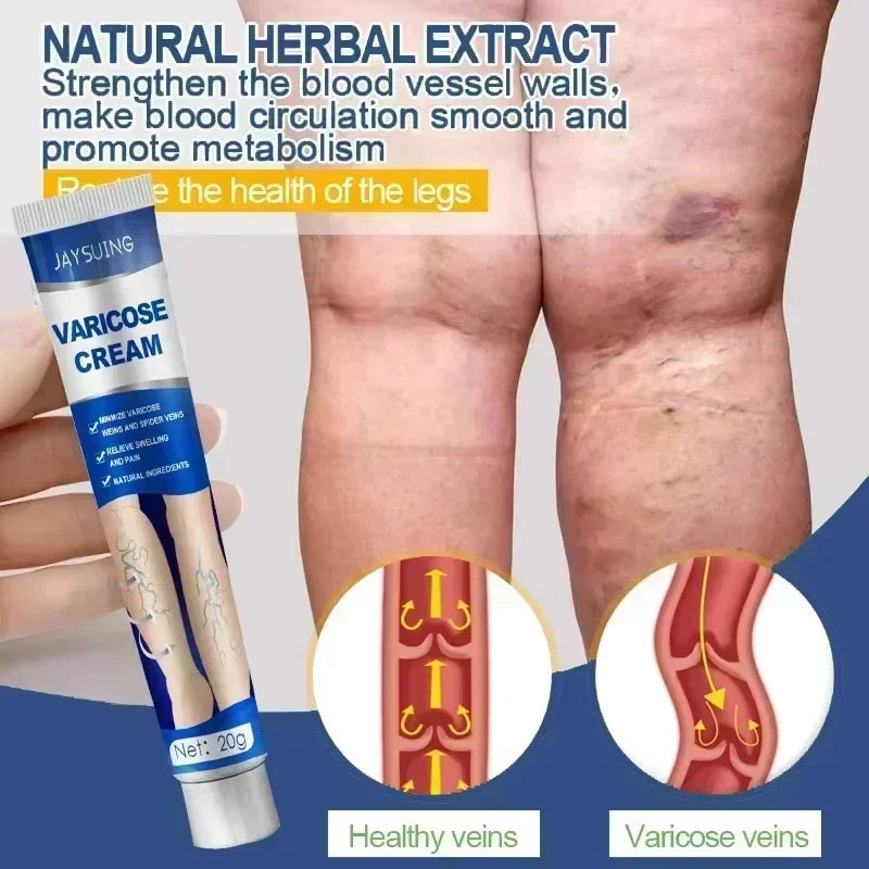 Varicose Vein Treatment for Legs | Spider Vein and Varicose Vein Cream | Collagen Protein