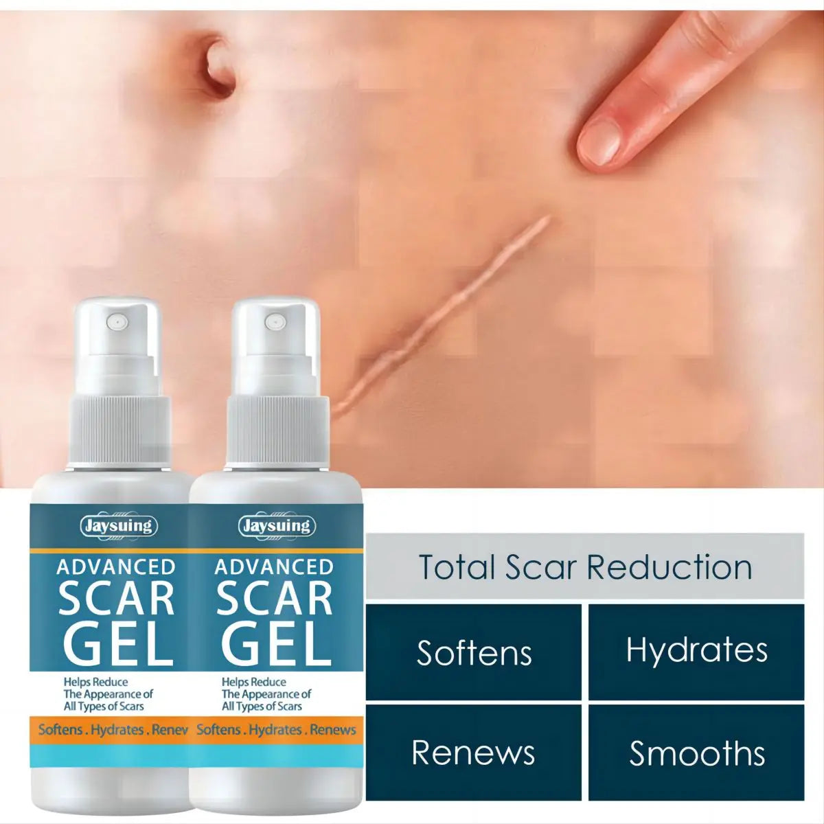 Jaysuing Fade Scar Cream Gel Skin Scar Repair