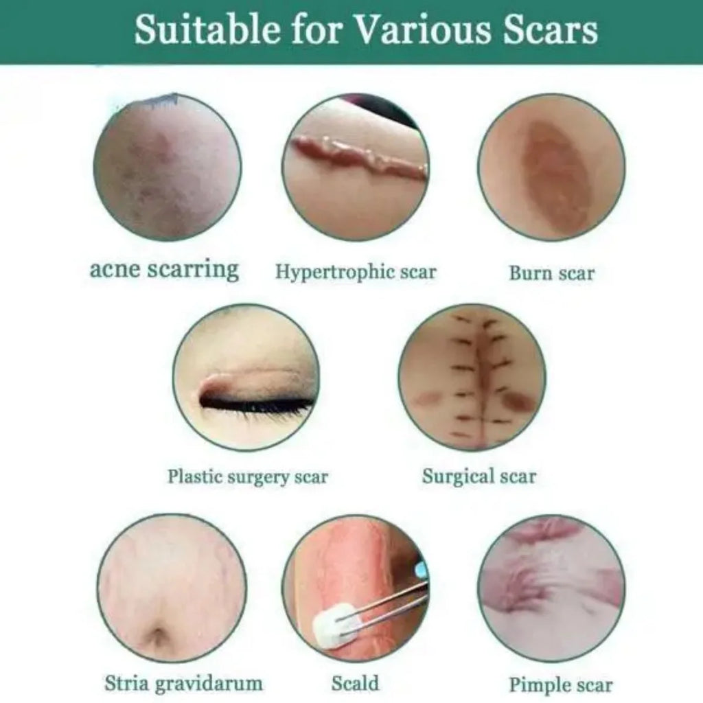Jaysuing Fade Scar Cream Gel Skin Scar Repair